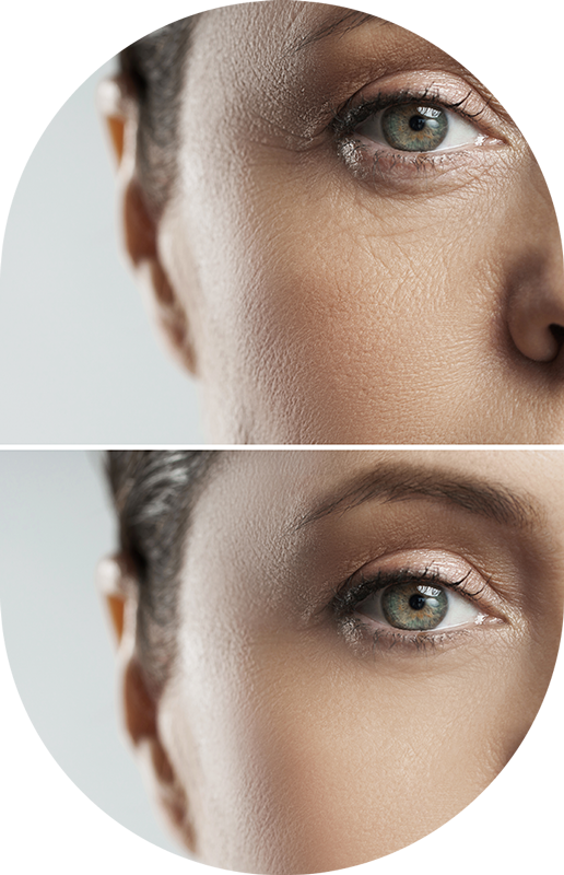 Última tecnología en belleza